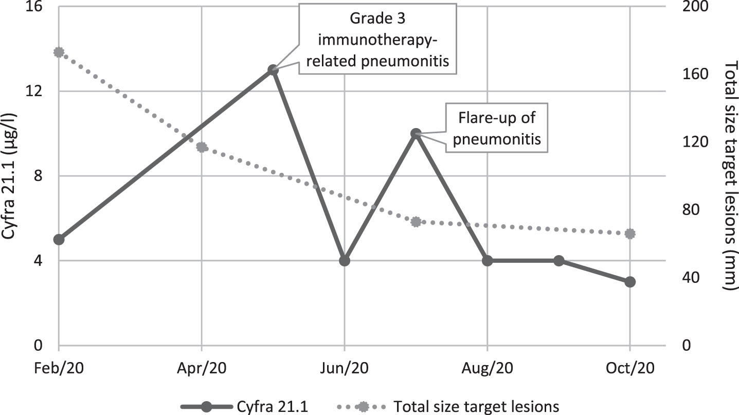 Serum tumor marker dynamics in immunotherapy-related pneumonitis.