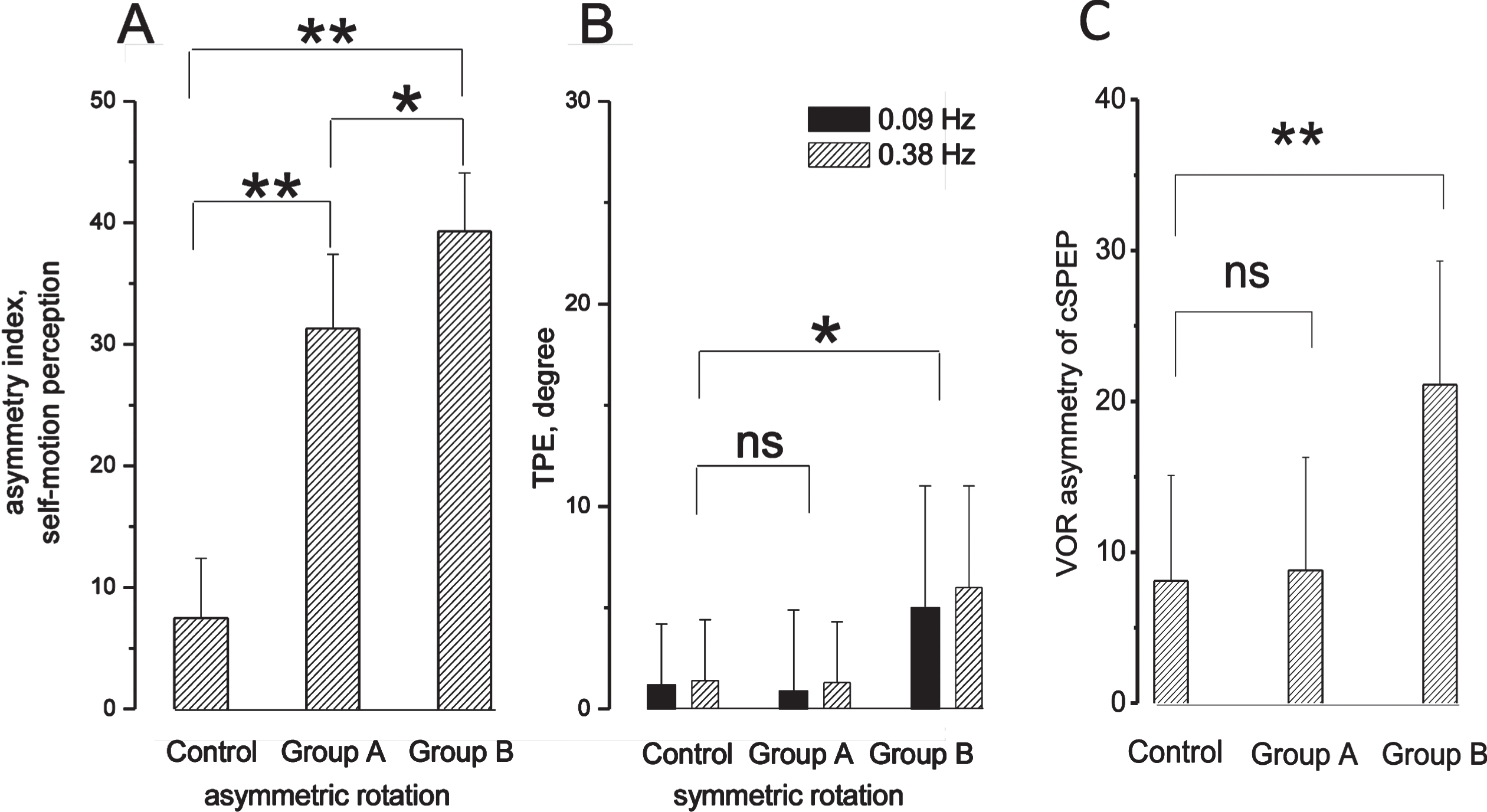 Asymmetry in the self-motion perception and VOR in MD patients with and without ocular reflex symptoms. A: Asymmetric index (mean and SD) of tracking position error in control, patients with ocular symptoms (group A) and without ocular symptoms (group B) in response to opposite directed asymmetric rotation. B: TPE at the end of symmetric rotation at frequencies of 0.09 Hz and 0.38 Hz. Significant difference: * (p < 0.05), ** (p < 0.001), non-significant difference: ns. C: Asymmetric index (mean and SD) of cumulative SPEP (cSPEP) of VOR in response to opposite directed asymmetric rotation in controls, and group A and B of MD patients. Significant difference: ** (p < 0.001), non-significant: ns.