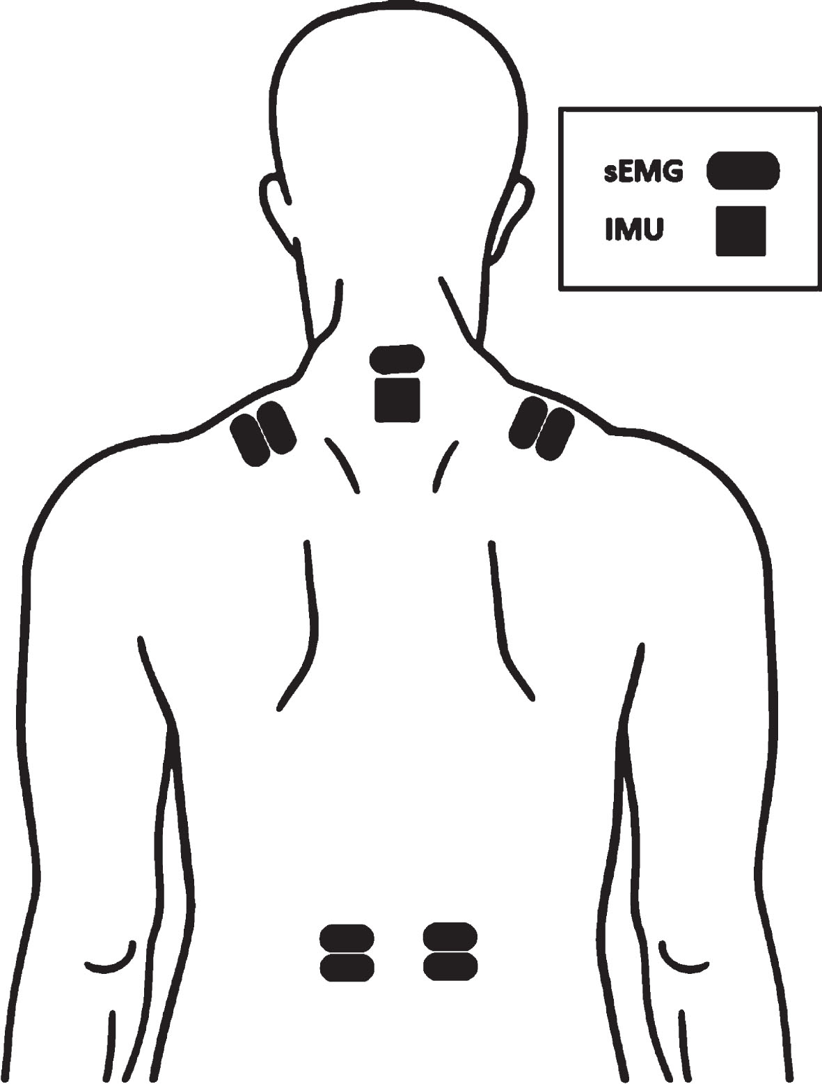 Placement of the surface electromyography (sEMG) electrodes over the dominant and non-dominant upper trapezius and erector spinae muscle and inertial measurement unit (IMU)-sensor. Of note the electrodes above the IMU served as reference electrode.