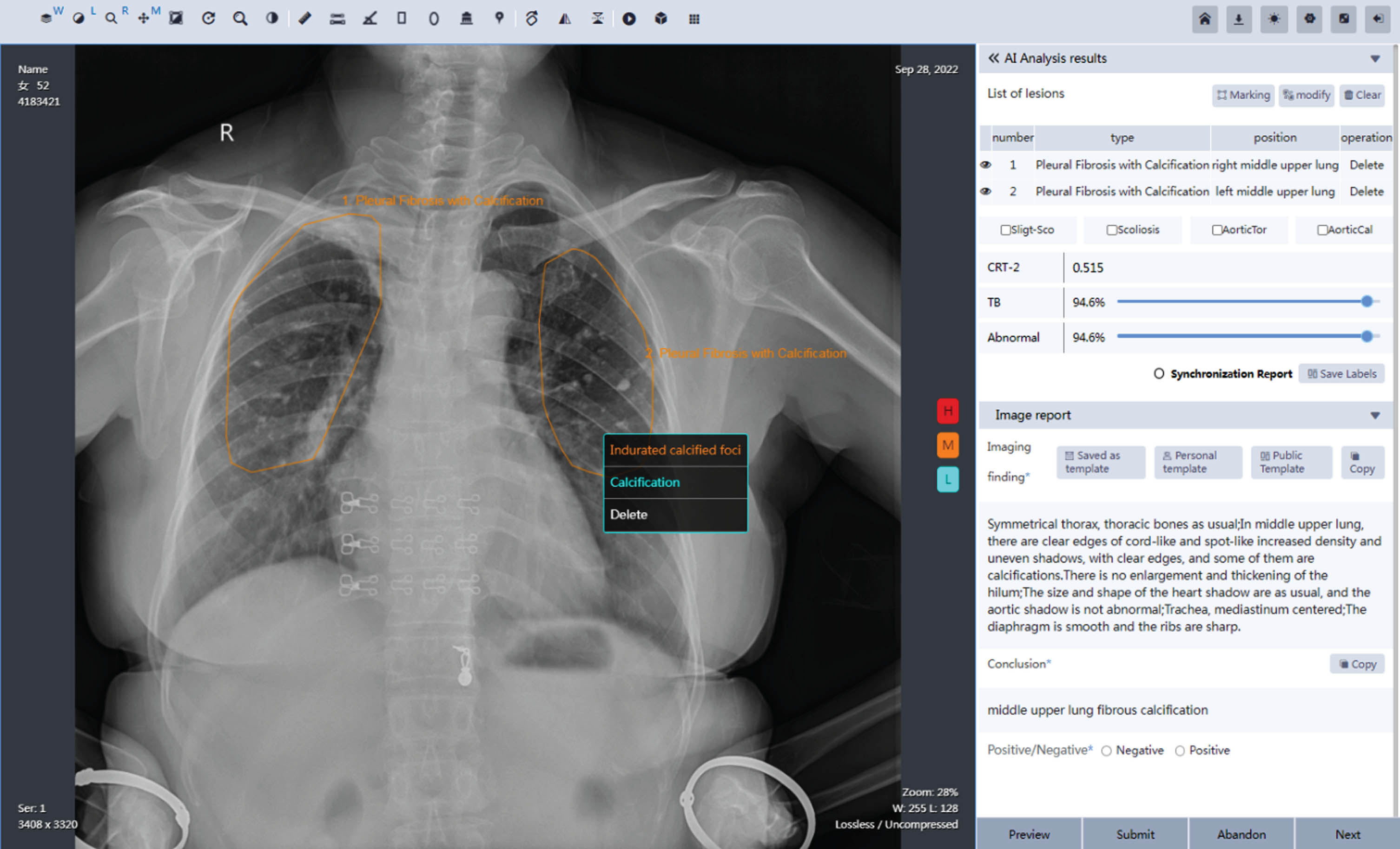 Visual representation of the graphical user interface (GUI) of the MOM-ClaSeg system.